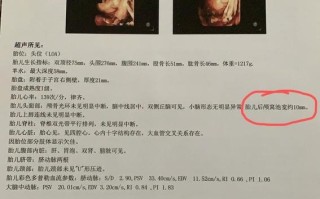 新生儿后颅窝池正常值范围是多少？不同孕周有何变化？异常情况如何识别？