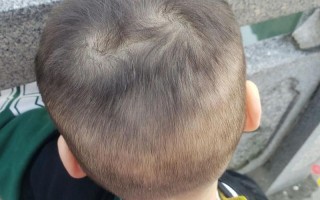 新生儿头总是转来转去是正常发育表现还是需要关注的异常信号？