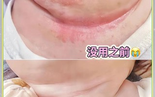 新生儿脖子淹了摸香油？这种土方法真的安全有效吗？