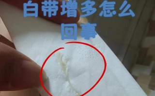 孕期白带拉丝是正常生理反应还是异常信号？需警惕哪些潜在风险？