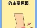 儿童脚后跟疼是什么原因有三