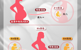 新生儿溶血为何不出现黄疸？是特殊情况还是漏诊信号？