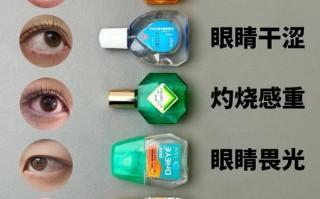 儿童结膜炎该用什么眼药水？不同类型结膜炎用药差异大，家长该如何正确选择？