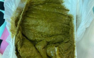 新生儿的大便为何呈现绿色？是正常现象还是健康预警？