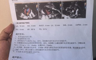 孕期心脏彩超到底该不该做？不做会有风险吗？医生会怎么建议？