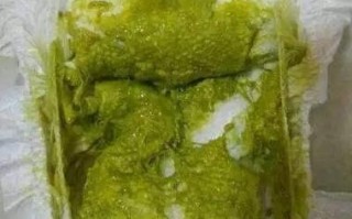 新生儿拉绿色便便是生病了吗？新手爸妈该如何应对？