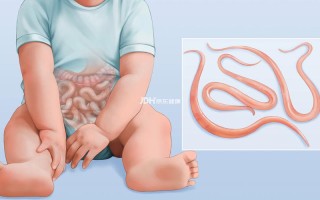 儿童肚子有蛔虫会出现哪些典型症状？家长该如何辨别和应对？