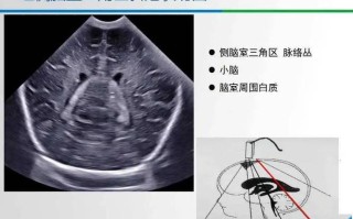 新生儿头颅彩超到底是什么检查，它对宝宝健康有何重要意义呢？