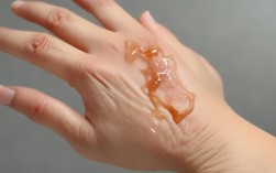 甲醛沾到皮肤，甲醛沾到皮肤会怎样