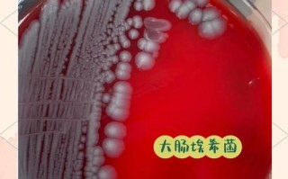 新生儿感染大肠埃希菌肺炎后，如何科学治疗并预防并发症？