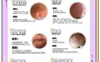 新生儿脸上长小痘痘咋处理？