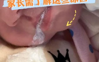 新生儿吐奶喷射状是正常现象吗？附图片解析原因与应对方法