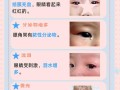 儿童眼睛红是上火还是疾病？家长该如何判断与处理？