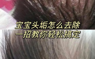 新生儿毛发浓密需要剃吗？会不会影响后续发育？护理时要注意什么？