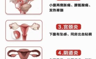 孕期外阴瘙痒分泌物多，是正常孕期反应还是妇科感染预警？