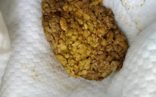 新生儿奶瓣是什么样子？家长该如何辨别与应对？