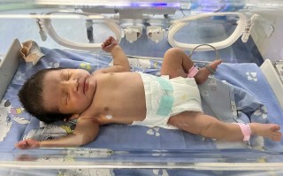 新生儿第三天出现黄疸，是正常生理现象还是需要警惕的异常信号？