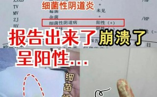 孕期白带呈豆渣样还痒，会不会是霉菌感染？对胎儿有影响吗？该怎么护理和治疗？