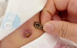 新生儿脐带脱落后洗澡，到底能不能碰水？该怎么护理才不会感染？