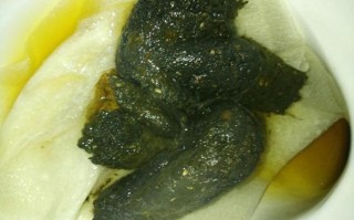 孕期服用爱乐维后大便变绿色，是正常现象还是身体异常信号？