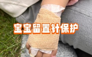 新生儿打留置针痛不痛