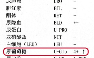 孕期尿常规葡萄糖14mmol/L是糖尿病吗？需要做糖耐量检查吗？