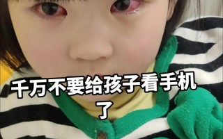 儿童沉迷玩手机，眼睛健康将面临哪些不可逆的潜在危害？