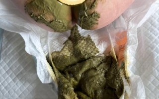 新生儿吃牛奶后不拉粑粑，是消化不良还是奶粉选错了？