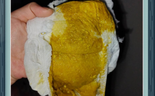 新生儿出生后排便正常吗？需要特别关注哪些情况？