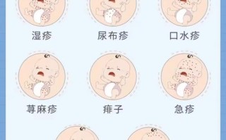 新生儿长热疹什么原因
