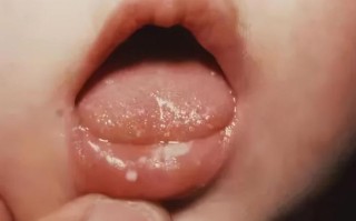 新生儿嘴上起白泡图片是正常的吗？需要担心什么问题？