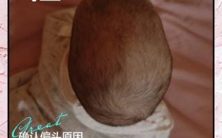 新生儿头型偏了会影响发育吗？如何科学调整与护理？