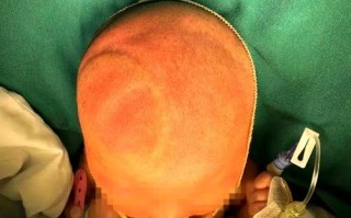 新生儿头部凹凸不平是正常现象还是异常信号？需要警惕哪些问题？