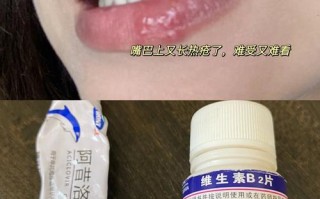 孕期嘴唇长泡能擦药吗？哪些安全药膏能缓解不适？