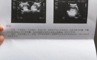 孕期七周没有胎心胎芽，是发育迟缓还是胚胎停育？需要怎么处理？