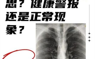 新生儿肺部罗音严重吗？需警惕哪些潜在风险与应对措施？