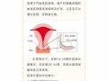 孕期宫颈短如何有效延长？科学方法与医学干预全解析