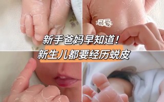 新生儿脱皮期间到底能不能洗澡？正确的清洁护理方法是什么？