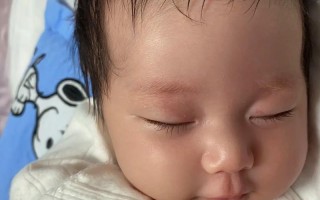 新生儿为什么手部肤色比面部更白皙？是生理现象还是健康信号？