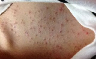 孕期外阴瘙痒是胎毒吗？其实可能是这些原因在作祟！