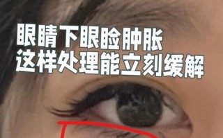 孕期眼睛肿是正常生理反应还是疾病信号？水肿背后隐藏哪些健康隐患？