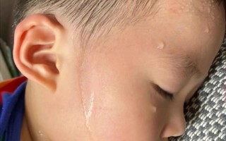 9岁儿童晚上睡觉出汗是缺钙还是体质虚？家长该如何科学应对？