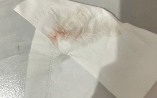 怀孕期间出现炎症出血，会对胎儿造成哪些不良影响？