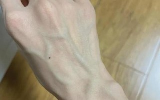 孕期手背青筋突然暴起是正常生理变化还是异常信号？需警惕哪些潜在风险？