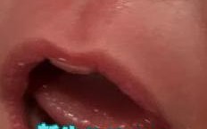 新生儿10天流黄鼻涕是正常现象还是感染信号？需警惕哪些潜在问题？