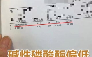 儿童碱性磷酸酶200多需要担心吗？是什么原因导致的？