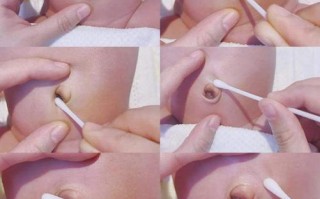 新生儿肚脐脱落后有分泌物怎么办？