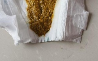 新生儿喝母乳后不排便，是攒肚还是便秘？需要干预吗？