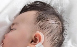 新生儿一只耳朵招风耳需要干预吗？会影响听力或后续发育吗？