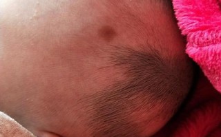 新生儿脸上红色斑是胎记还是血管瘤？需要治疗吗？